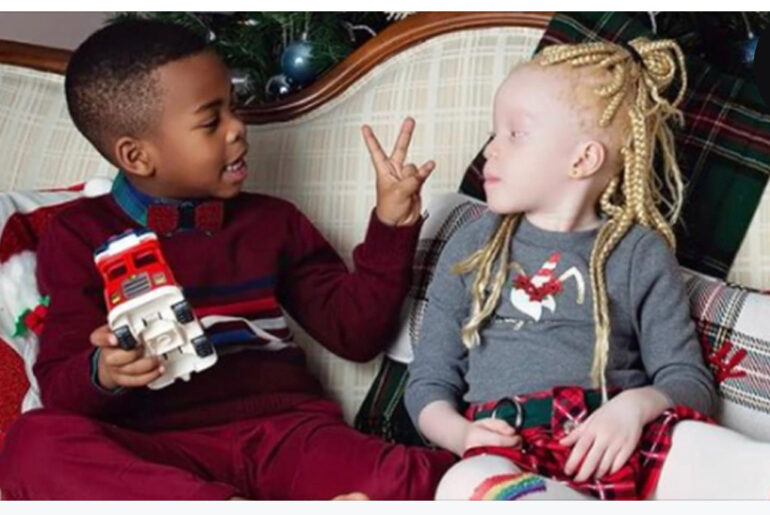 Mom gives birth to ‘black & white twins’ – teaches them to love their differences