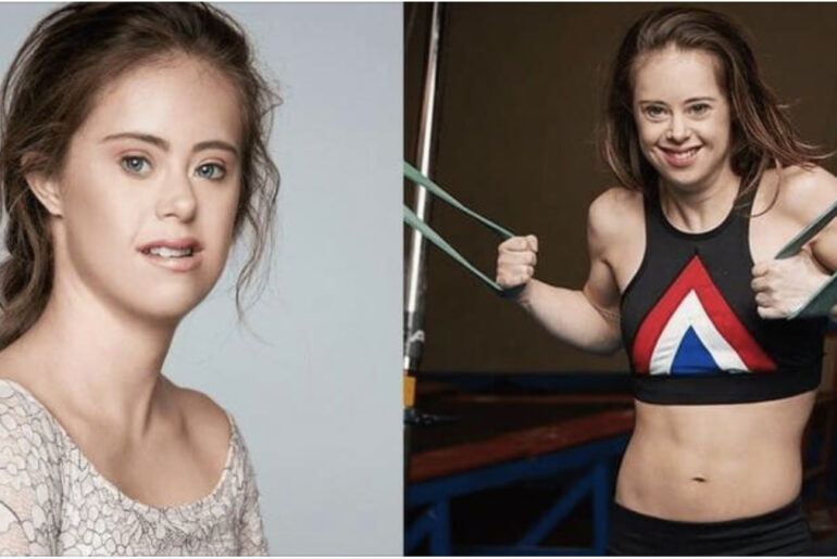 Champion gymnast with Down Syndrome becomes a stunning model, now inspires people around the world