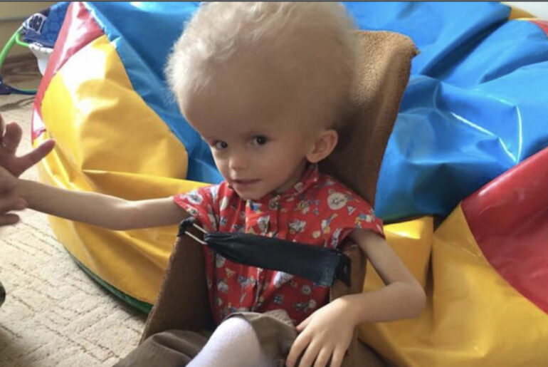 Mom gives up baby because of his head – 4 yrs later, there’s a knock on the orphanage door