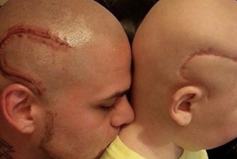 Dad Gets Tattooed So His Son With Cancer Won’t Feel Alone.