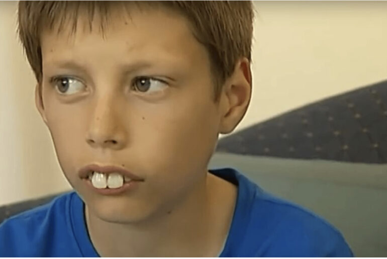 Boy bullied for his teeth and called ‘rabbit boy’ gets a new smile with some help from a loving community
