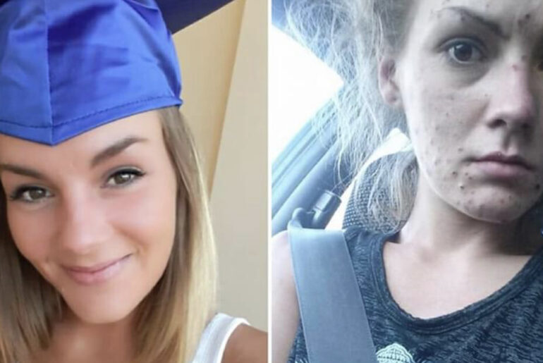 Young woman overcomes heroin & meth addiction and gets her diploma, now shares her journey in pictures
