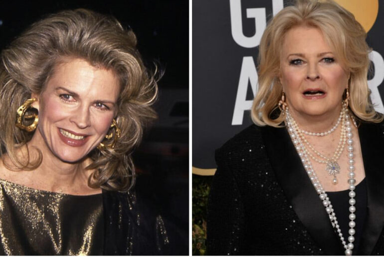 76-year-old Candice Bergen, says she is happy being ‘fat’ because she ‘lives to eat’