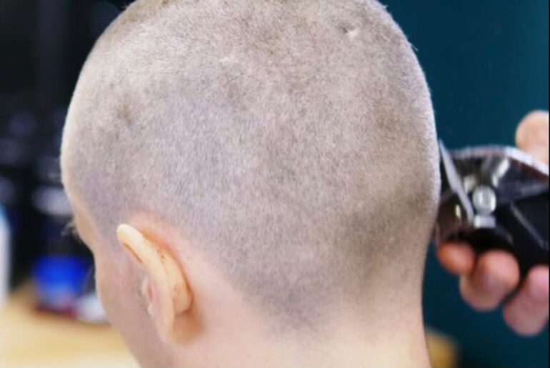 Dad Takes Extreme Action: Shaves Daughter’s Head After Bullying a Cancer-Stricken Classmate