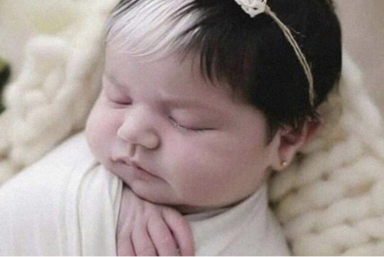 This little oddball with white hair is already three years old. What does she look like now