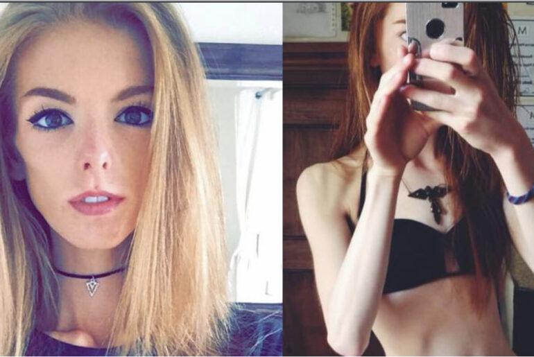 This woman only ate one piece of bread a day for 5 years – but look at her now