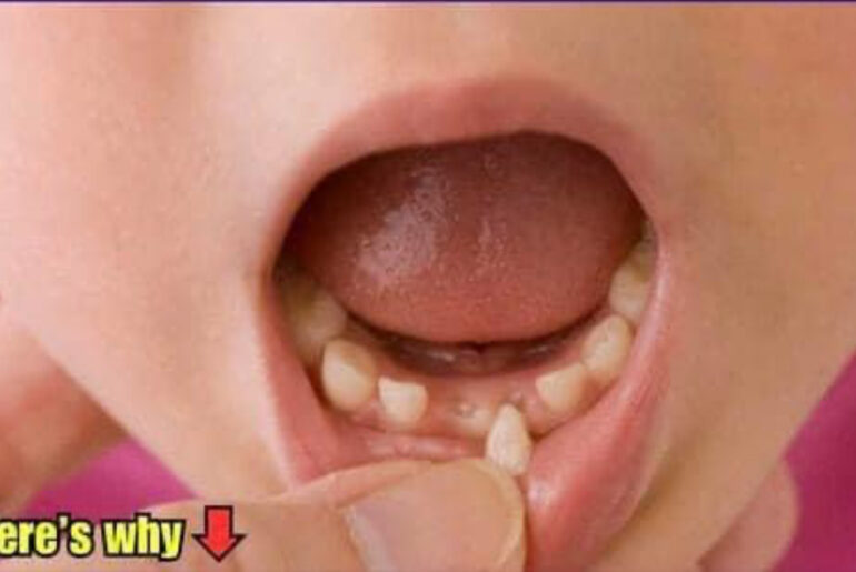 Dear parents, please always keep your children’s baby teeth! This could potentially save their lives in the future