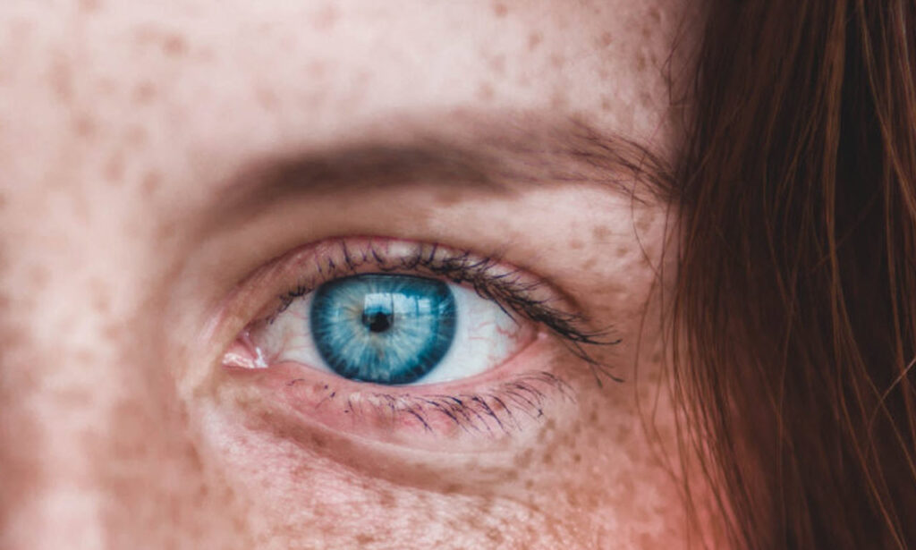 Experts Tell Us Everything We Need To Know About ‘Eye Floaters’ Info